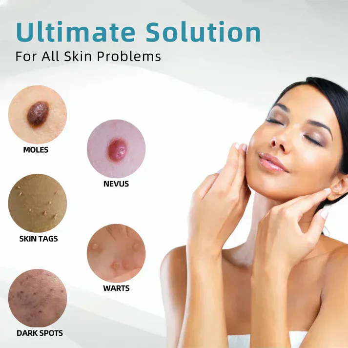 All-in-One CO₂ Laser Eraser Pen | Removes Moles. Warts. Skin Flaws & Pigmentation
