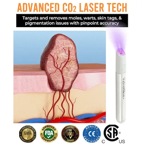 All-in-One CO₂ Laser Eraser Pen | Removes Moles. Warts. Skin Flaws & Pigmentation
