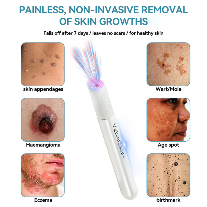 All-in-One CO₂ Laser Eraser Pen | Removes Moles. Warts. Skin Flaws & Pigmentation