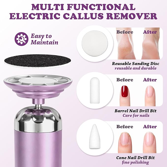 Electric Foot Callus Remover