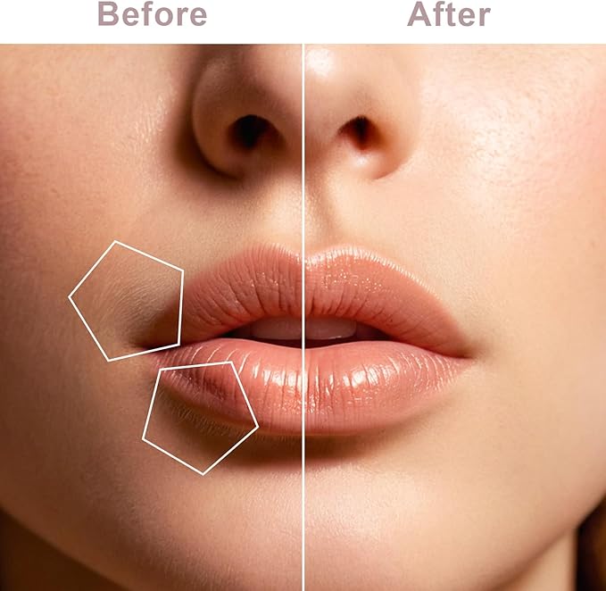 Facial Hair Remover for Women