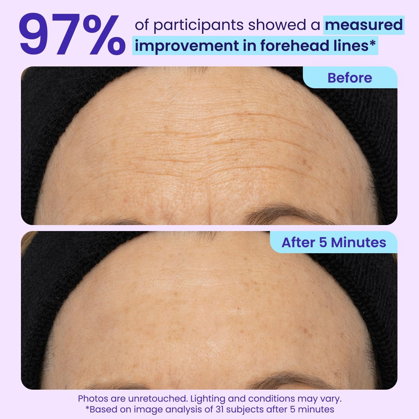 ✨ 2 Park Instant Lift Eye Gel – Smooth Wrinkles & Reduce the Look of Under-Eye Bags 👁️💜