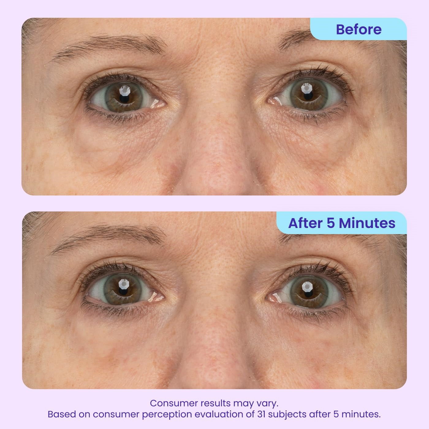 ✨ 2 Park Instant Lift Eye Gel – Smooth Wrinkles & Reduce the Look of Under-Eye Bags 👁️💜
